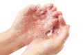Personal Hygiene
