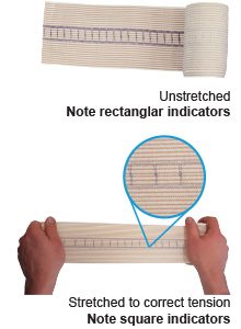 Snakebite bandage indicator
